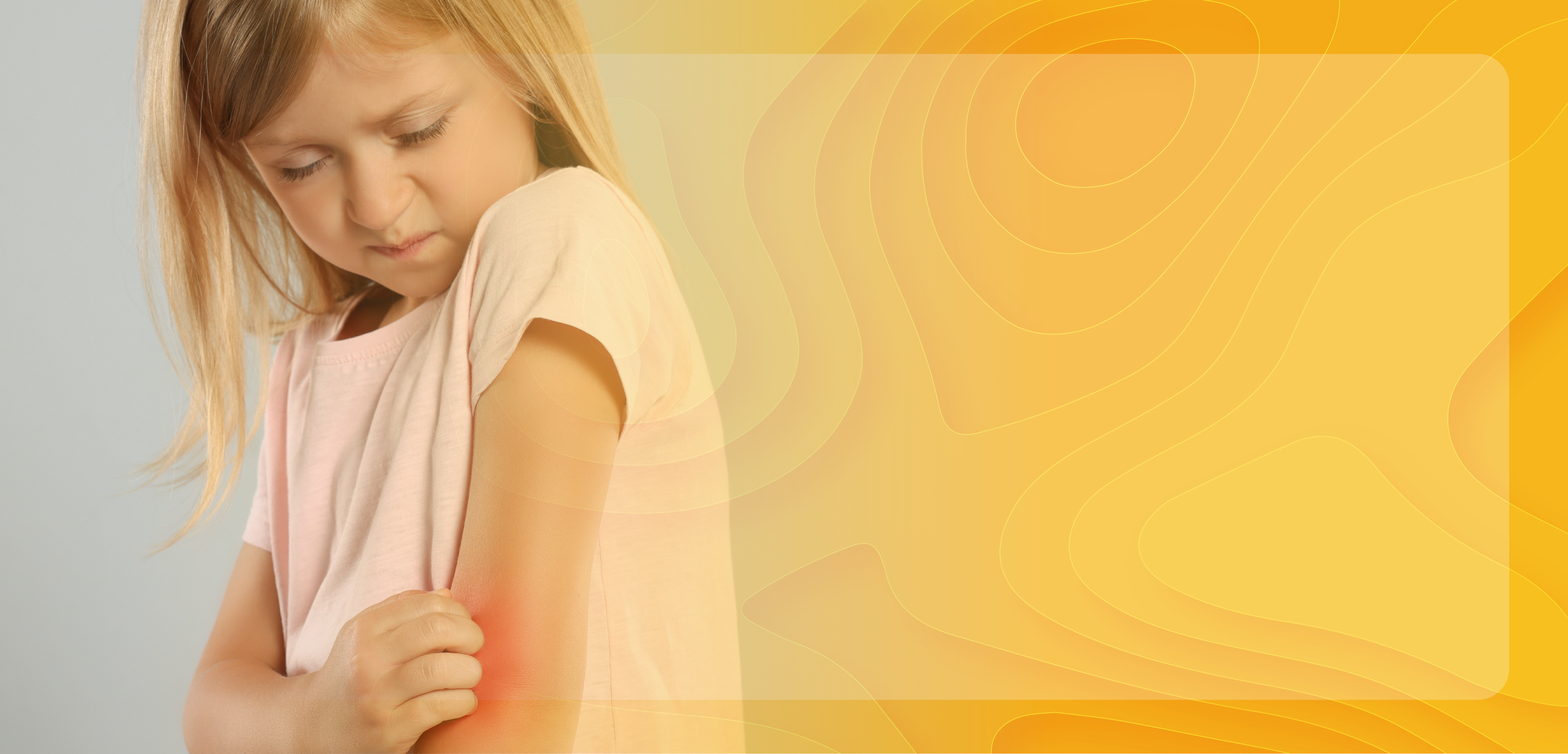 Addressing the Challenges of Treating Moderate to Severe Atopic Dermatitis With Targeted Biologic Therapies in Pediatric Patients