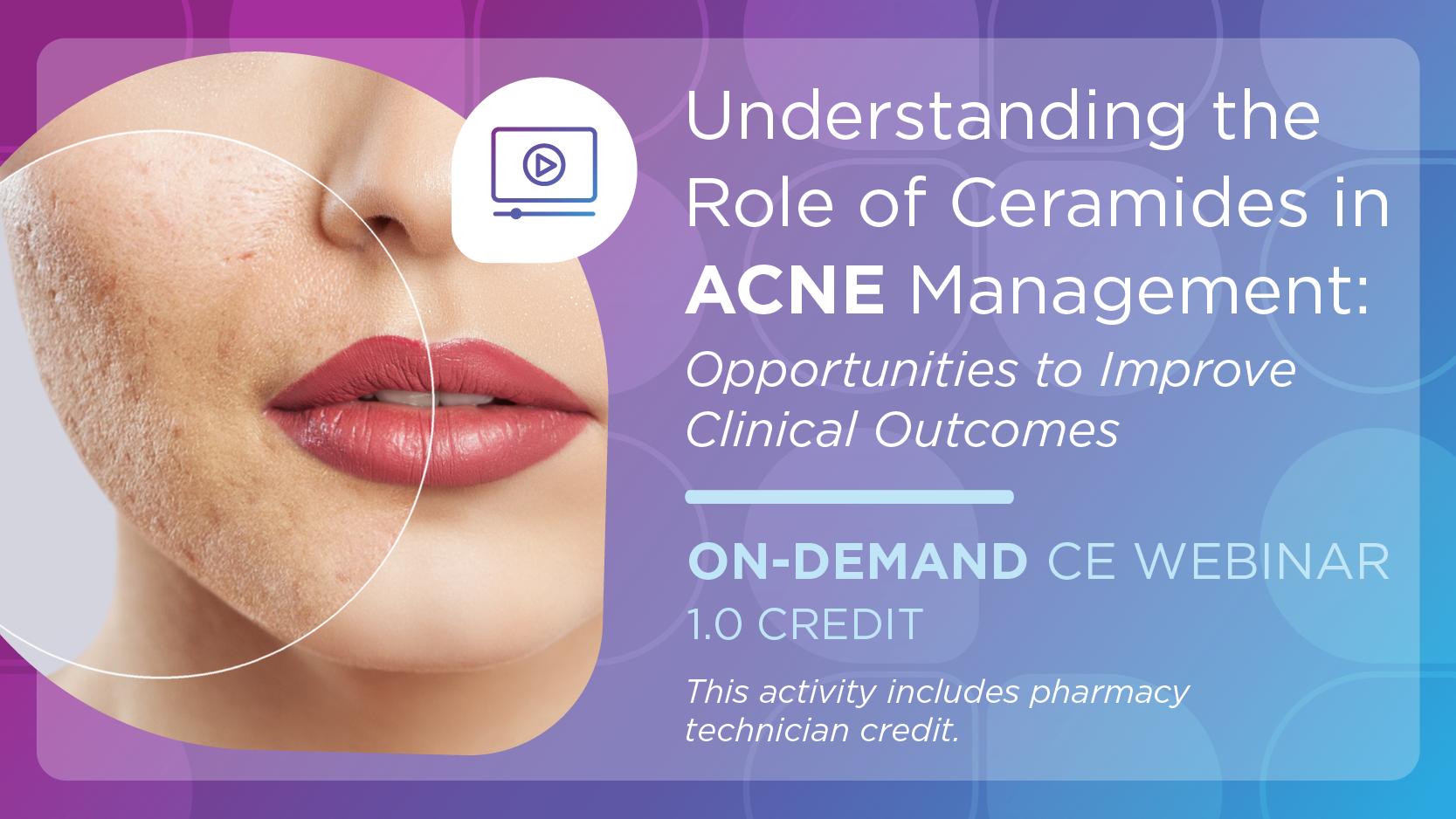 Understanding the Role of Ceramides in Acne Management: Opportunities to Improve Clinical Outcomes (Pharmacy Technician Credit)