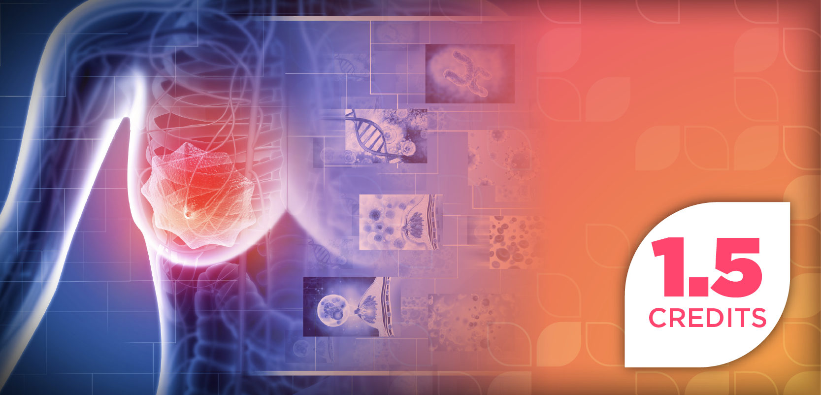 Navigating the Advancements in Oral Therapy Options in HR+ Metastatic Breast Cancer