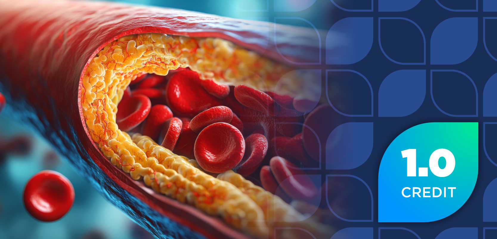 Hyperlipidemia Overview and the Clinical and Economic Burden