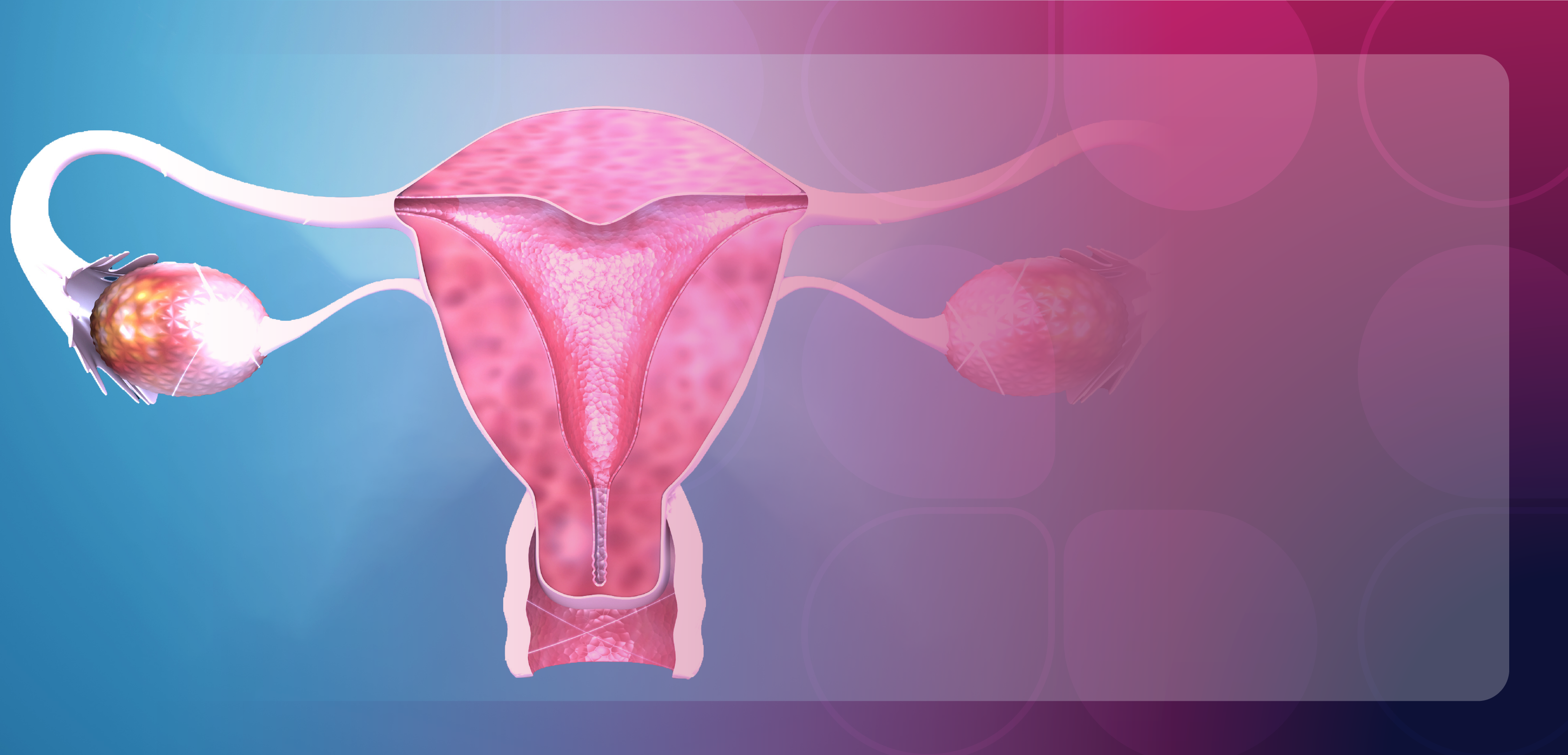 Mastering Immunotherapy-Based Approaches in Advanced Endometrial Cancer: A Pharmacist’s Perspective