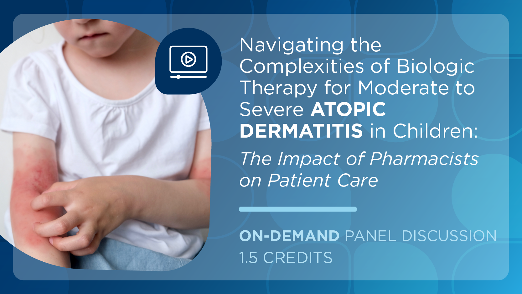Navigating the Complexities of Biologic Therapy for Moderate to Severe ...