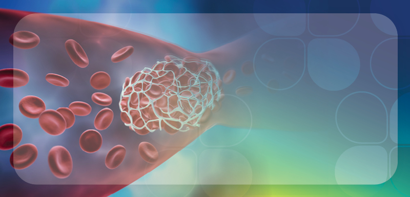 Venous Thromboembolism Prevention: What Pharmacists Need to Know