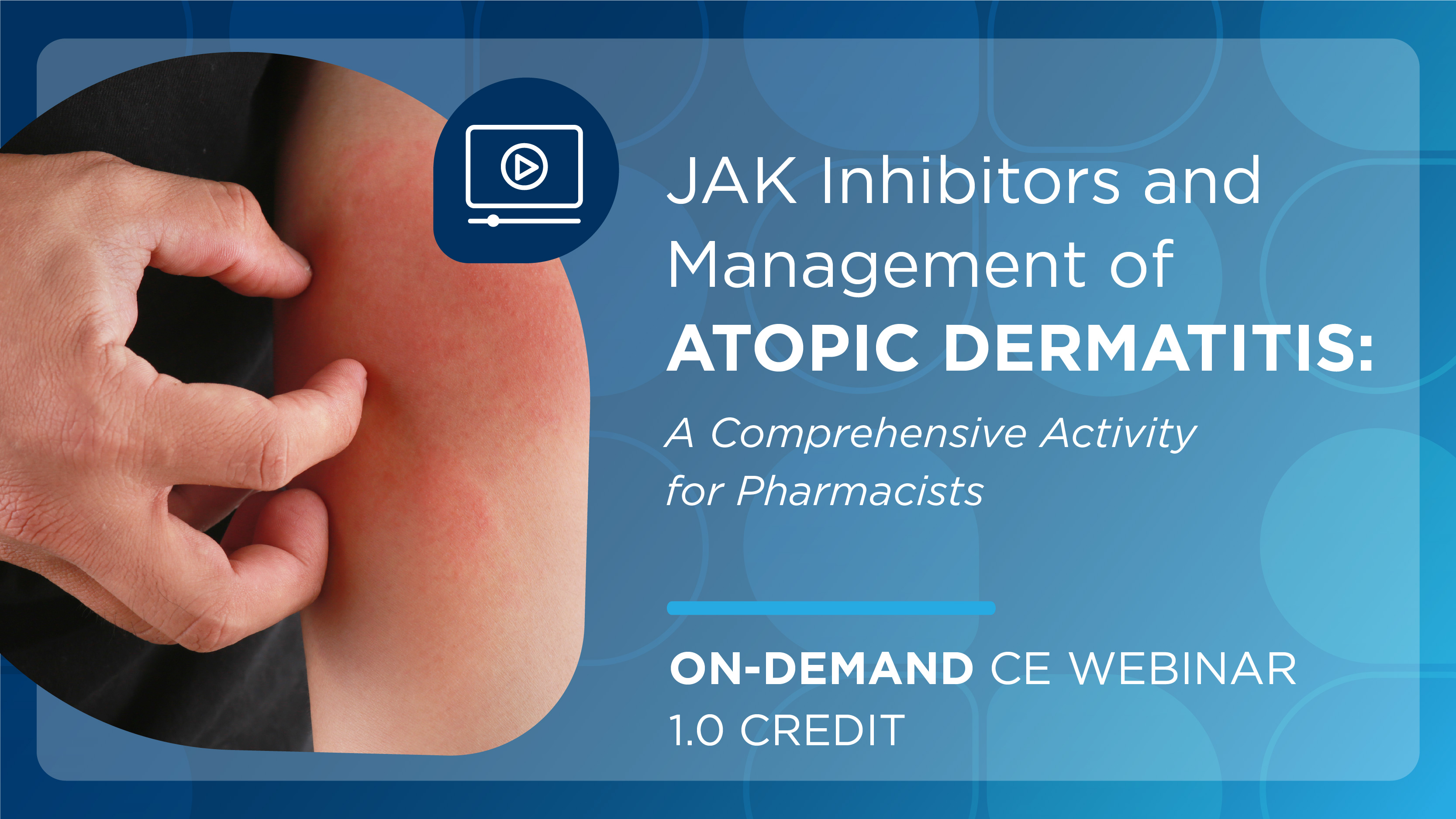 JAK Inhibitors and Management of Atopic Dermatitis: A Comprehensive Activity for Pharmacists