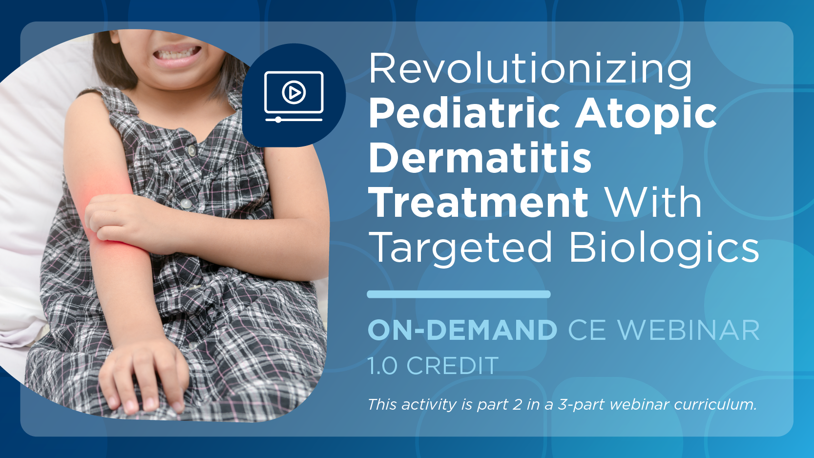 Revolutionizing Pediatric Atopic Dermatitis Treatment With Targeted Biologics