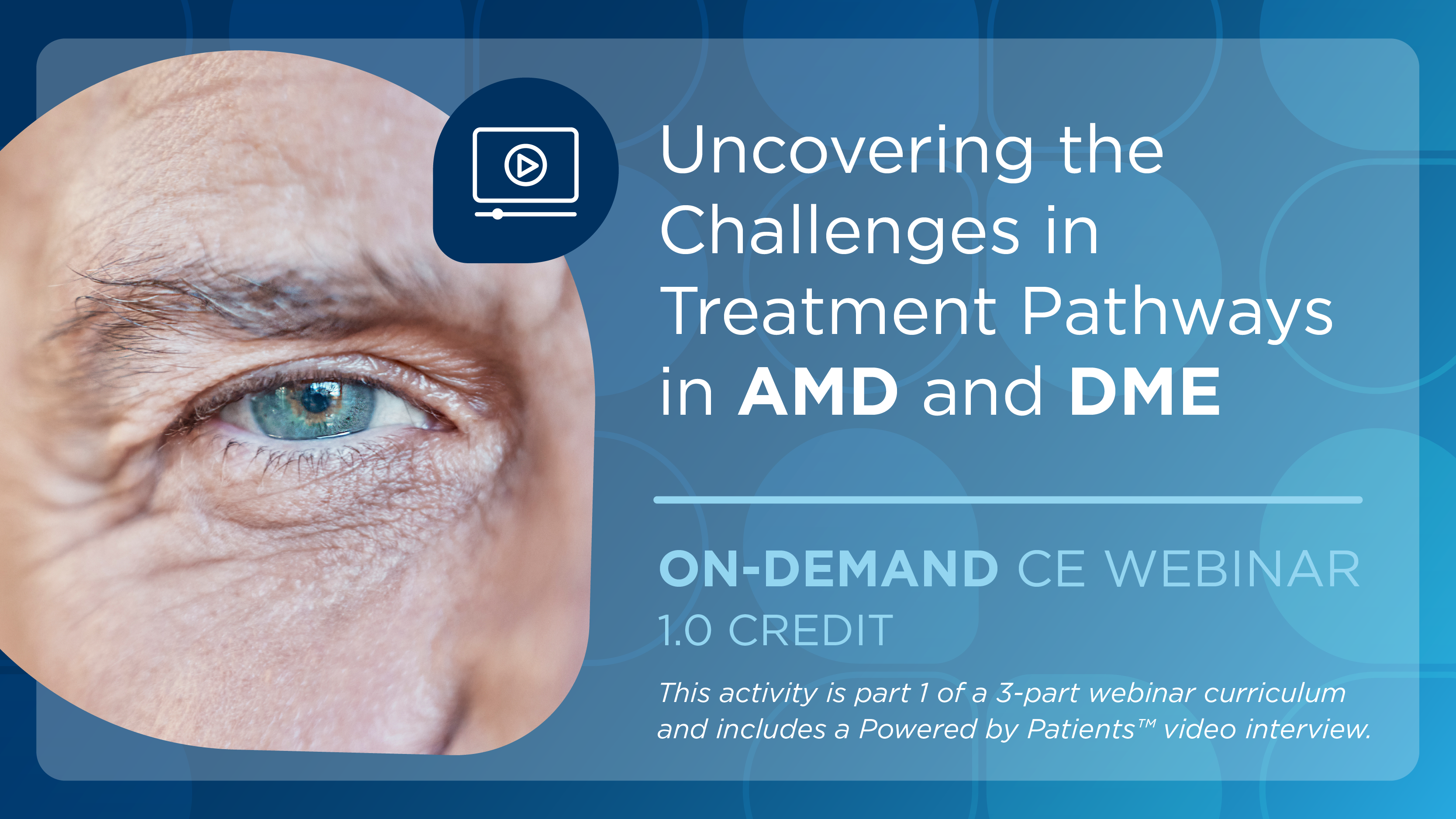 Uncovering the Challenges in Treatment Pathways in AMD and DME