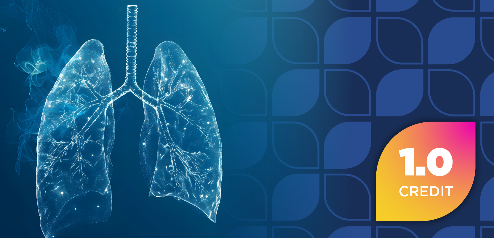 Transforming Small Cell Lung Cancer Management With DLL3-Targeted Therapies