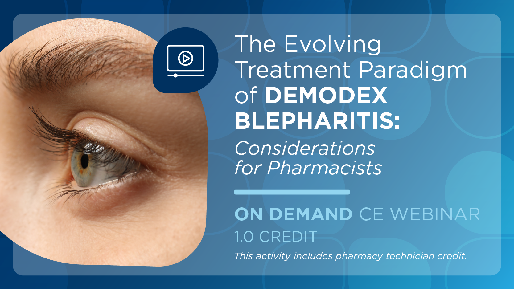 The Evolving Treatment Paradigm of Demodex Blepharitis: Considerations for Pharmacists (Pharmacist Credit)