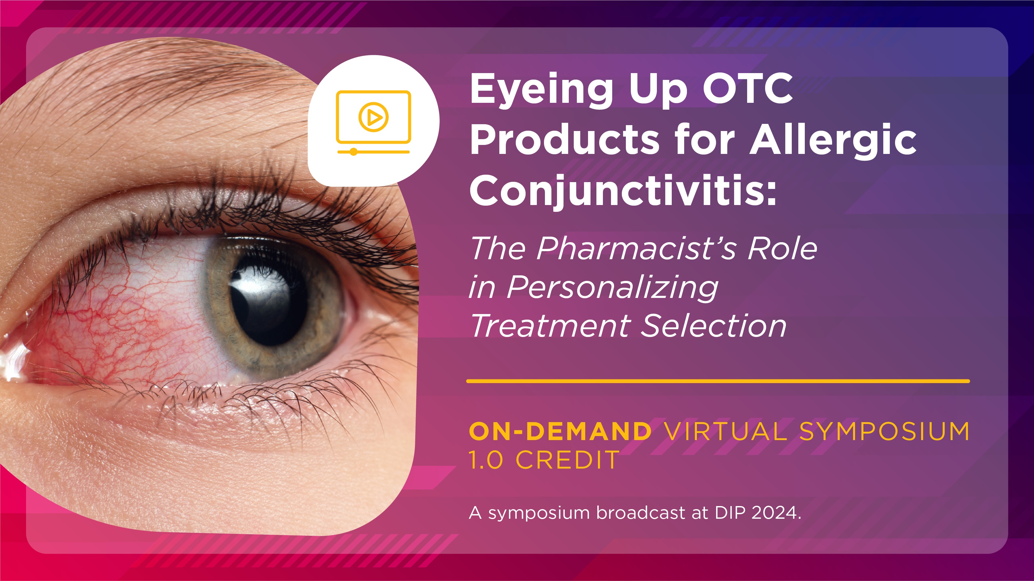 Eyeing Up OTC Products for Allergic Conjunctivitis: The Pharmacist’s Role in Personalizing Treatment Selection