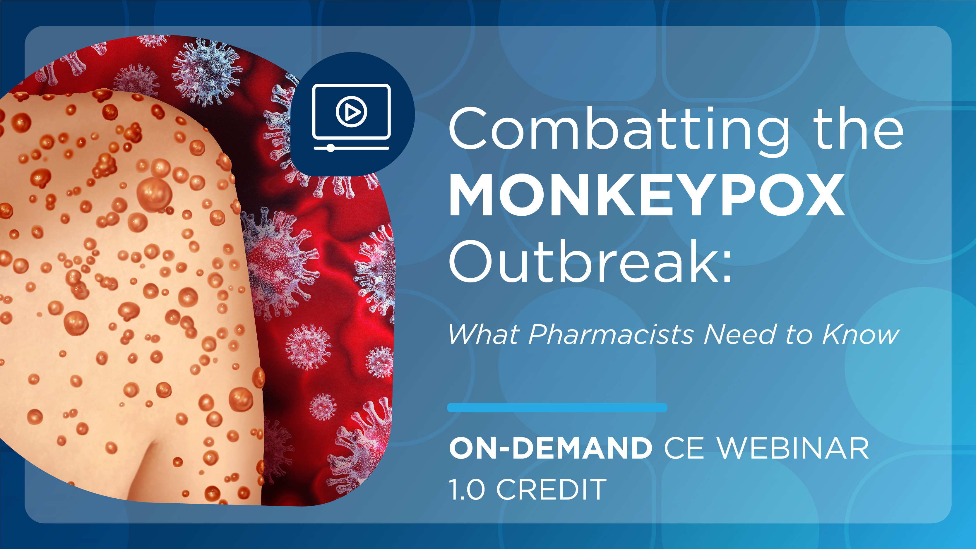 Combatting the Monkeypox Outbreak: What Pharmacists Need to Know