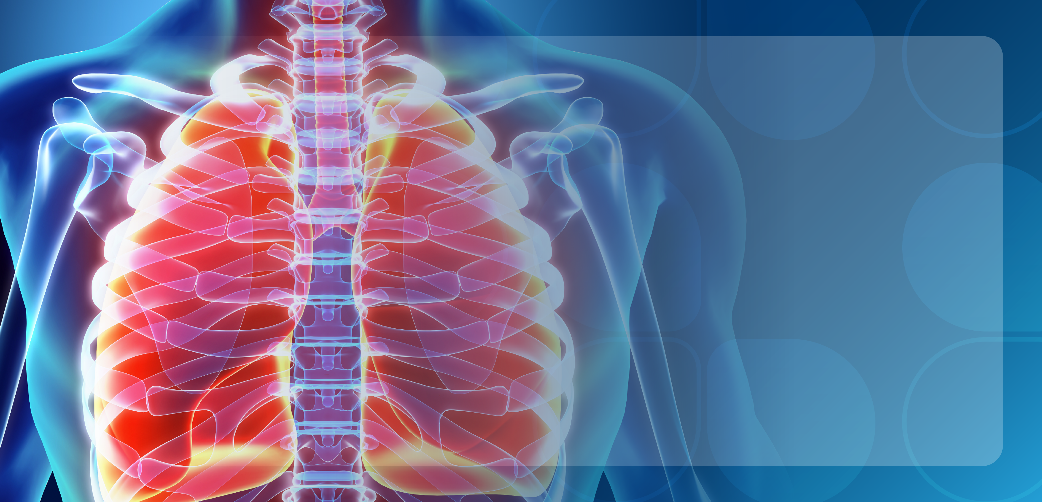 An Overview of Disease Burden Associated With COPD
