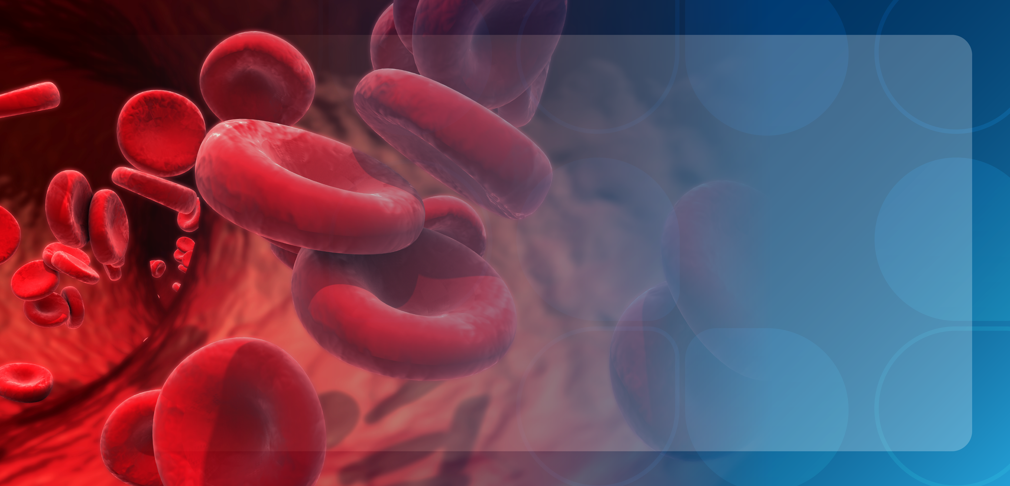 Overview of Paroxysmal Nocturnal Hemoglobinuria: Pathophysiology of the Complement Pathway and Clinical and Economic Burden, Featuring a Powered by Patients Interview